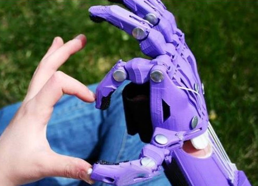 3D Printed Prototypes Parts For Prosthetic Arm Prototype