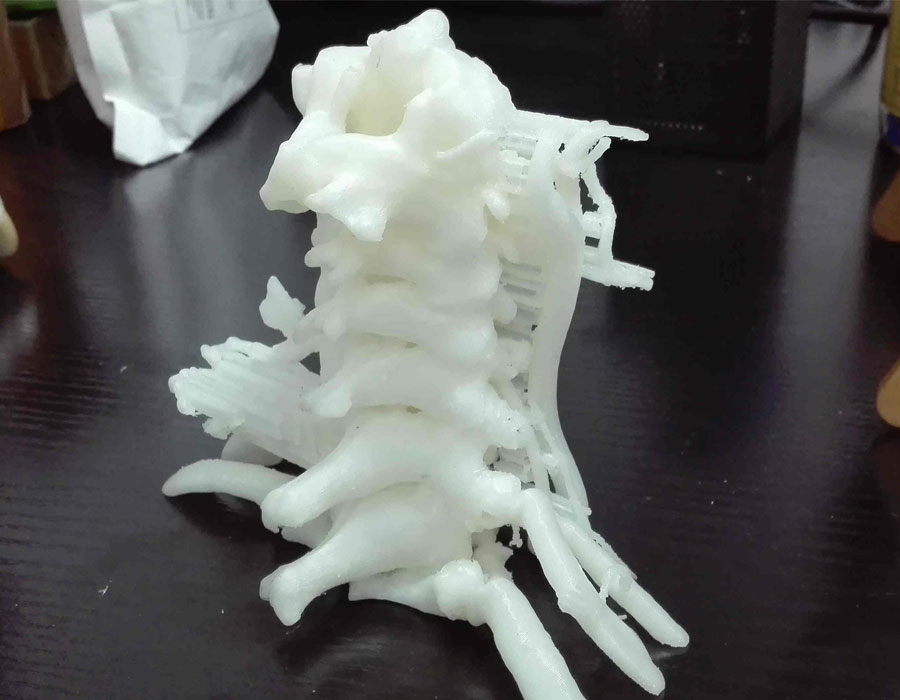 3D Printing Cervical Vertebrae Bone