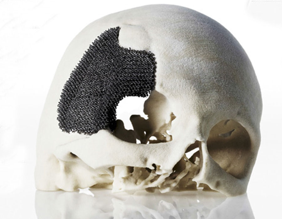 3D Printing Skull