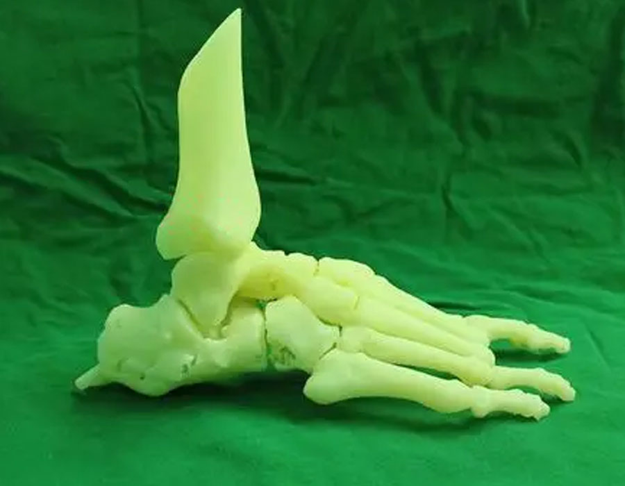 3D Printing Toe Bone And Leg Bone