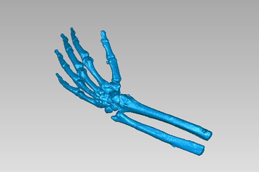 Hand bone model