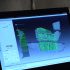 Three-Dimensional Scanner Makes The Prosthetic More Warm