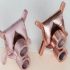 3D printed smartphone plug-in brings affordable vocal cord diagnostic tool