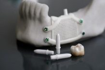 Ceramic 3D printing takes a new step in dental products