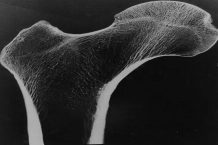 Human bones may decipher how to extend the fatigue life of 3D printed lightweight structures