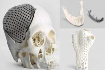 The Application Exploration Of 3D Printed Bones In The Medical Orthopedics Field