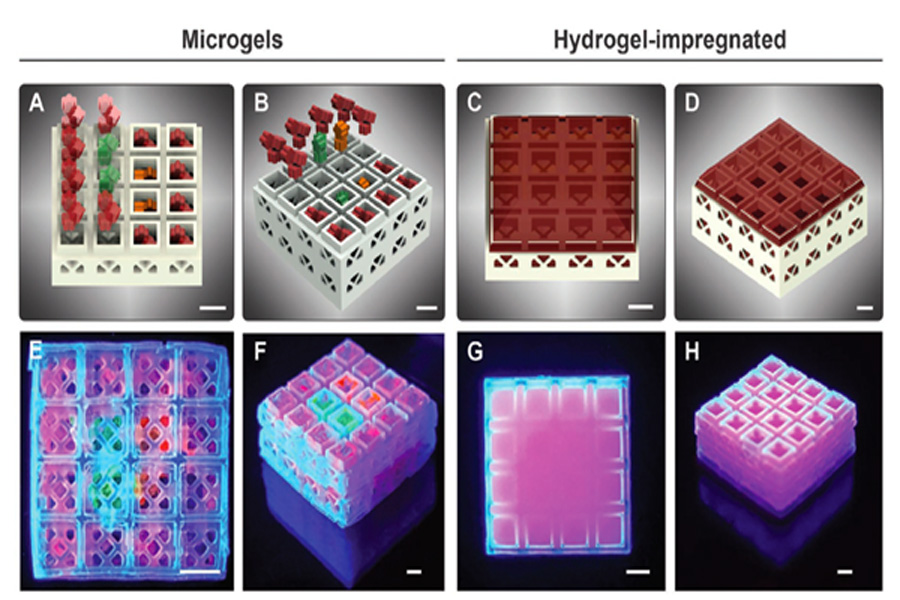 Researchers are inspired by Lego to develop 3D printed self-healing "bone bricks" Researchers at Oregon Health and Science University (OHSU) used 3D printed miniature Lego-style "bone bricks" that have the potential to heal fractured bone tissue. The researchers' tiny hollow block is only the size of a small flea, and can be used as a scaffold, allowing both hard and soft tissues to grow on it. In addition, the stackable nature of the modules allows them to be interlocked like building blocks, providing scalability and thousands of potential geometric configurations. Ultimately, the Oregon team aims to expand the scale of the technology and use organs made in the microcage production laboratory for human transplantation. "The scaffold we are applying for a patent is easy to use; Dr. Luiz Bertassoni, associate professor of biomedical engineering at OHSU School of Medicine, said: "It can be stacked like Lego and placed in thousands of different configurations to suit almost any situation. Complexity and size. 3D printed biomaterial scaffold In recent years, the biological structure of printed scaffolds has become a research hotspot, especially for applications in tissue engineering or regenerative medicine. In addition, advances in 3D printing technology have enabled patient-specific implantable structures to be designed in a more extensible manner. In some cases, they can even be produced on-site in hospitals. As a result, specialized equipment is no longer required to assemble these complex tissues, thereby reducing the lead time associated with implant production. Nevertheless, the development of an ideal scaffolding system has proven to be elusive, which is still one of the reasons why the technology has not been more widely adopted in the hospital environment. The ideal tissue support must not only be compatible with the defect-specific architecture, but also allow for the controlled loading of cells, growth factors, and hydrogels. In addition, according to the Colorado team, temporary control of the tissue is essential for the ingrowth of the tissue within the graft material. 3D printed bone bricks by the Oregon team Conventionally, plastic surgeons repair complex fractures by implanting metal rods or metal plates into the patient's body to stabilize the bones. Only in the later stages of the process, biocompatible scaffold materials containing powders or pastes are used to promote healing. On the other hand, the Oregon team has developed a novel scaffolding system that can accurately place hollow blocks containing a small amount of growth factor gel in the most needed position. The co-author of the study, Dr. Ramesh Subbiah, a postdoctoral fellow in the Bertassoni OHSU laboratory, explained: “The 3D printed microcage technology improves healing by stimulating the growth of the right cell types at the right place and at the right time. Different growth factors can be placed in Within each block, we can repair tissues more accurately and faster." The team’s miniature cages are hollow inside, allowing them to load cargoes of different biogel compositions in a controlled manner and create scaffolds with spatially deterministic indicators. As a proof of concept, the 3D team printed many blocks containing micro-particle hydrogels containing various growth factors. The results showed that the cells entered the scaffold in a fast and controlled manner, thereby accelerating the formation and healing process of new tissue. 3D printing modular design for testing researchers The team used β-tricalcium phosphate ceramics and a photolithography-based ceramic manufacturing (LCM) 3D printing technology to create many modular miniature cage systems. The block size produced by this process is 3.375 mm3, the hollow size is 1.5×1.5×1.5 mm, and the wall thickness is 230–560 µm. In short, using sample tiles, researchers can easily create various shapes while maintaining a consistent outline around them. The Oregon team studied four-layer 4×4 blocks, and a total of 29,413 configurations can be configured, thus highlighting the potential of this technology in patient-customized bone stents. To illustrate the suitability of its method for use with other rigid polymer materials, many other bricks were created using methacrylate-based resins, which are often used in similar regeneration procedures. In order to demonstrate the potential of scaffolding in regenerative applications, the team used digital light processing (DLP) 3D printing technology to create a series of special-shaped products with five-point flower-like geometric shapes. Then different combinations of human recombinant growth factors were manually loaded into modules of various shapes. After stacking, the strength of the two-layer blocks was significantly reduced to 13.8 MPa, but this was still much higher than the reported average jawbone strength of 3.9 MPa. In addition, further experiments found that the growth factor-filled blocks placed near the repaired rat bones caused blood vessel growth three times that of traditional scaffolding materials. As a result, the researchers concluded that although their method has been optimized for hard tissue repair, the concept may be applicable to other tissue regeneration applications. Through extensive research, the Oregon team believes that the modular approach can be used to repair more complex fractures in larger animals, and even for human transplants. Additive manufacturing and bone repair Many researchers from academic institutions around the world are already exploring the concept of 3D bioprinted bone implants. For example, researchers at the University of Manchester have developed bone bricks similar to the Oregon team. The device was created to meet emergency medical needs in Syrian refugee camps. At the same time, researchers at Delft University of Technology have designed and printed porous titanium bone implants with antibacterial properties. The synergistic antibacterial behavior of the graft may result in a new type of implant that allows the patient to maintain a minimum of life. On the other hand, scientists at Texas A&M University combined 3D printing, biomaterial engineering and stem cell biology to create a new and more efficient facial bone graft. The highly osteogenic scaffold not only promotes the growth of bone cells, but also serves as a solid platform for bone regeneration.